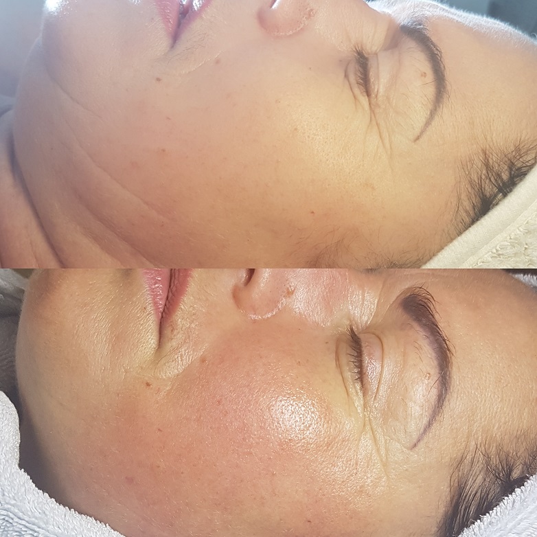 Massages4u - Facials