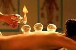 Massages4u - Chinese Fire Cupping