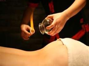 Massages4u - Chinese Fire Cupping