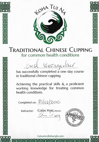 Chinese Fire Cupping